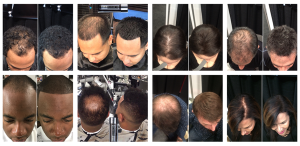 100% Real Hair Fibers BROWN 18g 100% Real Hair Fibers BROWN 18g