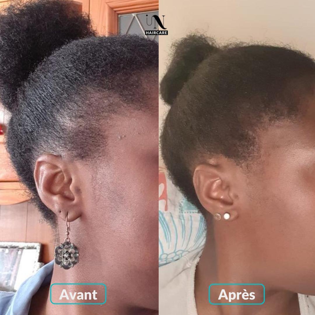 gummies-cure-pousse-de-cheveux-3-mois-1-chouchou-en-satin-offert-423594